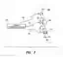 Fig. 12 - Treatment of movement disorders by brain stimulation
