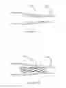 Fig. 02 - Conformable stents and methods for making