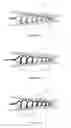 Fig. 08 - Conformable stents and methods for making
