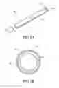 Fig. 02 - Intravascular cerebral catheter device and method of use