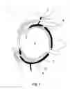 Fig. 02 - NEEDLE FOR OPHTHALMIC PROCEDURES