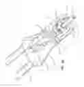 Fig. 09 - Proximally trimmable catheter including pre-attached bifurcation and related methods