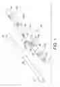 Fig. 02 - Bone fracture treatment devices and methods of their use