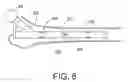 Fig. 09 - Bone fracture treatment devices and methods of their use
