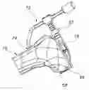 Fig. 01 - Methods and apparatus for performing knee arthroplasty