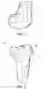 Fig. 02 - Methods and apparatus for performing knee arthroplasty