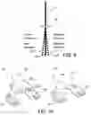 Fig. 06 - Methods and apparatus for performing knee arthroplasty