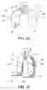 Fig. 09 - Methods and apparatus for performing knee arthroplasty
