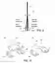 Fig. 06 - Methods and apparatus for performing knee arthroplasty