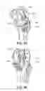 Fig. 35 - Methods and apparatus for performing knee arthroplasty