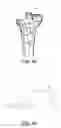 Fig. 43 - Methods and apparatus for performing knee arthroplasty