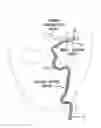 Fig. 01 - Intracorporeal grasping device