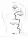 Fig. 06 - Intracorporeal grasping device