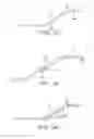 Fig. 09 - Intracorporeal grasping device