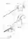 Fig. 02 - TISSUE COMPRESSION USING SURGICAL CLIPS