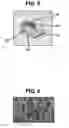 Fig. 06 - Device and method for repair of urological structures