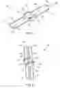 Fig. 02 - Linear clamps for anastomosis