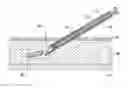 Fig. 01 - Method for constructing an instrument with a covered bore for subcutaneous implantation