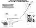 Fig. 01 - Catheter device for the dynamic regulation of the venous return to the heart for the treatment of patients with heart failure