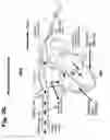 Fig. 04 - Catheter device for the dynamic regulation of the venous return to the heart for the treatment of patients with heart failure