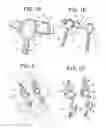 Fig. 02 - Posterior dynamic stabilization device having a mobile anchor