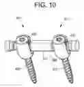Fig. 09 - Posterior dynamic stabilization device having a mobile anchor