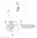 Fig. 17 - Devices and methods for dynamic fixation of skeletal structure