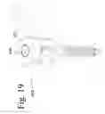 Fig. 19 - Devices and methods for dynamic fixation of skeletal structure