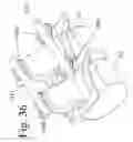 Fig. 35 - Devices and methods for dynamic fixation of skeletal structure