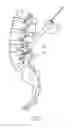 Fig. 04 - SYSTEM AND METHOD FOR SPINAL FIXATION