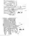 Fig. 07 - Bone repair system and method