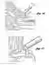 Fig. 08 - Bone repair system and method