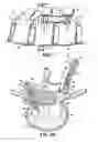 Fig. 02 - Bone anchor system