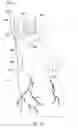 Fig. 07 - Subcardiac threshold vagal nerve stimulation