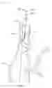 Fig. 08 - Subcardiac threshold vagal nerve stimulation