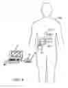 Fig. 05 - System and method for performing percutaneous nerve field stimulation with concurrent anode intensified spinal cord stimulation