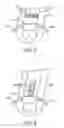 Fig. 06 - System and method for performing percutaneous nerve field stimulation with concurrent anode intensified spinal cord stimulation