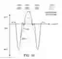 Fig. 09 - System and method for performing percutaneous nerve field stimulation with concurrent anode intensified spinal cord stimulation