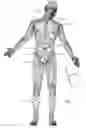 Fig. 02 - Implanted lead sleeve having RFID tag