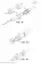 Fig. 09 - STENTS, DEVICES FOR USE WITH STENTS AND METHODS RELATING THERETO