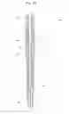 Fig. 19 - Stent delivery device