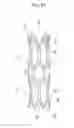Fig. 21 - Stent delivery device