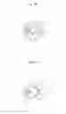 Fig. 26 - Stent delivery device