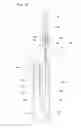 Fig. 48 - Stent delivery device