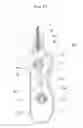 Fig. 51 - Stent delivery device