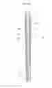 Fig. 54 - Stent delivery device