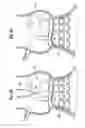 Fig. 06 - Unitary quick connect prosthetic heart valve and deployment system and methods