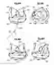 Fig. 28 - Unitary quick connect prosthetic heart valve and deployment system and methods