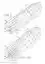 Fig. 05 - SCREW THREAD PLACEMENT IN A POROUS MEDICAL DEVICE