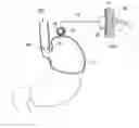 Fig. 01 - Device for treating obesity